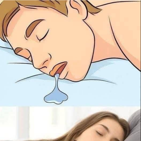 🛌Babear al dormir: Cuando es Normal? Que es lo que Revela sobre tu Descanso