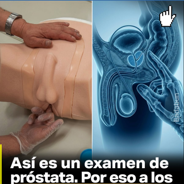 🩺 El examen de próstata: Por qué unos segundos de «pena» valen más que toda una vida